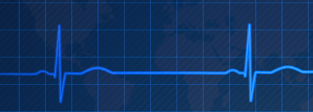 ekg line